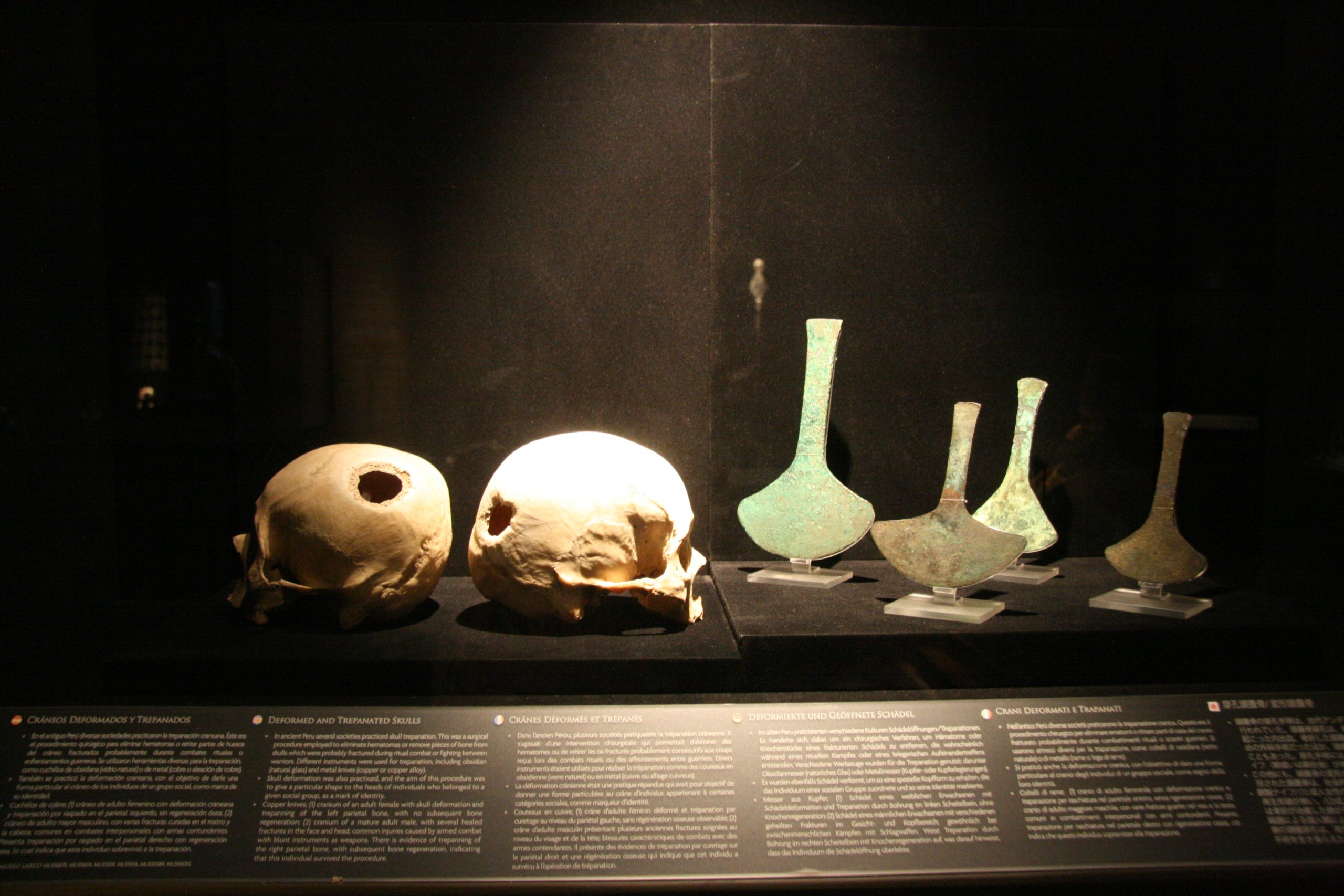 Crânes déformés et trépanés – Museo Larco